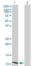 Anti-HSD17B12 Mouse Polyclonal Antibody