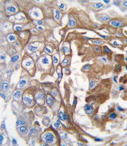 Anti-NRAS Rabbit Polyclonal Antibody