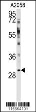 Anti-WBP2 Rabbit Polyclonal Antibody