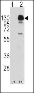 Anti-PDGFRA Rabbit Polyclonal Antibody (FITC (Fluorescein))