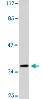 Anti-SRY Rabbit Polyclonal Antibody