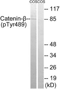 Anti-beta Catenin Rabbit Polyclonal Antibody