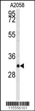 Anti-RC3H1 Rabbit Polyclonal Antibody