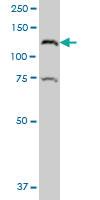 Anti-CTNND2 Mouse Polyclonal Antibody