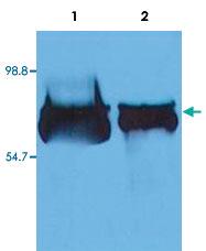 Anti-ALB Mouse Monoclonal Antibody [clone: AL-01]