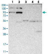 Anti-FER Rabbit Polyclonal Antibody