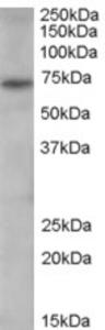 EB06547 (0.3 µg/ml) staining of human spleen lysate (35 µg protein in RIPA buffer).  Primary incubation was 1 hour.  Detected by chemiluminescence.