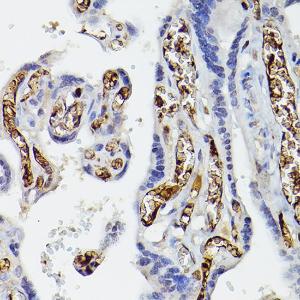 Anti-Apolipoprotein E Rabbit Polyclonal Antibody