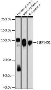 Western blot analysis of extracts of various cell lines, using Anti-C1 inhibitor Antibody [ARC2427] (A308724) at 1:1,000 dilution The secondary antibody was Goat Anti-Rabbit IgG H&L Antibody (HRP) at 1:10,000 dilution Lysates/proteins were present at 25 µg per lane