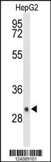 Anti-DIO3 Rabbit Polyclonal Antibody