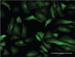 Anti-S100 A10 Mouse Monoclonal Antibody [clone: 3E10]