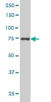 Anti-MED17 Mouse Monoclonal Antibody [clone: 4D4]