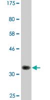 Anti-RPS6KA6 Mouse Monoclonal Antibody [clone: 3G12]