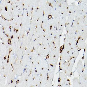 Anti-Apolipoprotein E Rabbit Polyclonal Antibody