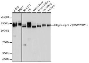 Western blot analysis of extracts of various cell lines, using Anti-Integrin alpha V Antibody [ARC50621] (A308725) at 1:1,000 dilution