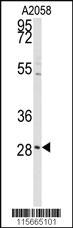 Anti-PRKCDBP Rabbit Polyclonal Antibody