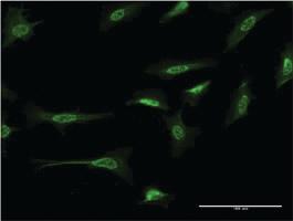 Anti-CTNND2 Mouse Monoclonal Antibody [clone: 1E3]