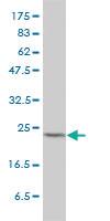 Anti-MAD2L1 Mouse Monoclonal Antibody [clone: 2E2-1D6]