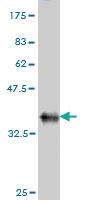 Anti-ACTL7B Mouse Monoclonal Antibody [clone: 6A4]