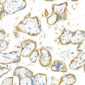 Immunohistochemistry analysis of paraffin-embedded human placenta using Anti-Integrin alpha V Antibody [ARC50621] (A308725) at a dilution of 1:100(40X lens). Perform microwave antigen retrieval with 10 mM PBS buffer pH 7.2 before commencing with IHC staining protocol