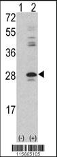 Anti-PRKCDBP Rabbit Polyclonal Antibody