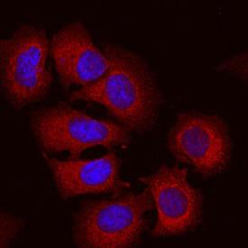 Anti-SEMA3C Mouse Monoclonal Antibody [clone: 757820]