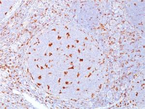 Immunohistochemical analysis of formalin-fixed, paraffin-embedded human tonsil using Anti-CD68 Antibody [C68/684]