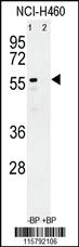 Anti-CYP3A4 Rabbit Polyclonal Antibody