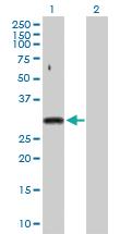 Anti-SNRPA Rabbit Polyclonal Antibody