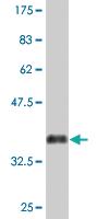 Anti-ACRC Mouse Monoclonal Antibody [clone: 2E4]