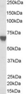 EB06556 (0.03 µg/ml) staining of A431 lysate (35 µg protein in RIPA buffer).  Primary incubation was 1 hour.  Detected by chemiluminescence.