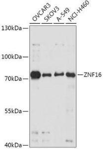 Anti-ZNF16 Rabbit Polyclonal Antibody