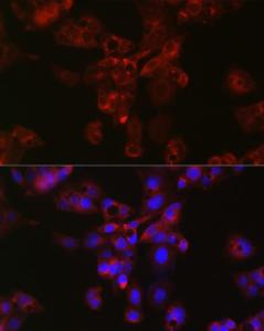 Anti-Apolipoprotein E Rabbit Polyclonal Antibody