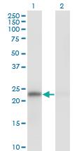 Anti-MAD2L1 Mouse Monoclonal Antibody [clone: 2E2-1D6]