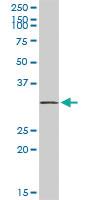 Anti-SNRPA Rabbit Polyclonal Antibody