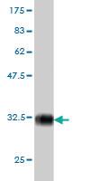 Anti-PIGP Mouse Monoclonal Antibody [clone: 2E7]