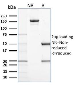 SDS-PAGE analysis of Anti-CD68 Antibody [C68/684] under non-reduced and reduced conditions; showing intact IgG and intact heavy and light chains, respectively. SDS-PAGE analysis confirms the integrity and purity of the antibody.