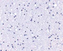 Anti-ANAPC1 Rabbit Polyclonal Antibody