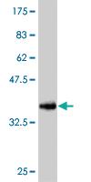 Anti-RPS6KA6 Mouse Monoclonal Antibody [clone: 8D2]