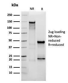 SDS-PAGE analysis of Anti-Vimentin Antibody [VIM/3736] under non-reduced and reduced conditions; showing intact IgG and intact heavy and light chains, respectively SDS-PAGE analysis confirms the integrity and purity of the antibody