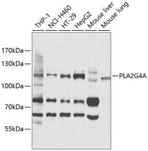 Western blot analysis of extracts of various cell lines, using Anti-Cytosolic Phospholipase A2 Antibody (A11147) at 1:1,000 dilution