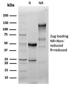 Anti-Fascin Rabbit Recombinant Antibody [Clone: FSCN1/6465R]