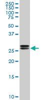 Anti-HMGB2 Mouse Monoclonal Antibody [clone: 3E5]