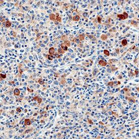 Anti-Siglec-11 Mouse Monoclonal Antibody [clone: 705904]