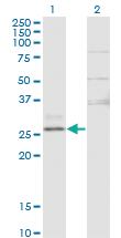 Anti-CTRB1 Mouse Monoclonal Antibody [clone: 3C8]