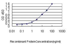 Anti-MAD2L1 Mouse Monoclonal Antibody [clone: 2E2-1D6]