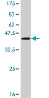 Anti-RIPK4 Mouse Monoclonal Antibody [clone: 1G2]