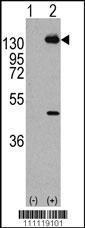 Anti-PDGFRA Rabbit Polyclonal Antibody (FITC (Fluorescein))