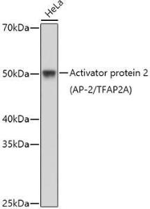 Western blot analysis of extracts of HeLa cells, using Anti-Transcription factor AP-2-alpha Antibody (A11149) at 1:1,000 dilution