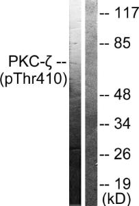 Western blot analysis of lysates from NIH/3T3 cells treated with PMA 125ng/ml 30' using Anti-PKC zeta (phospho Thr410) Antibody. The right hand lane represents a negative control, where the antibody is blocked by the immunising peptide